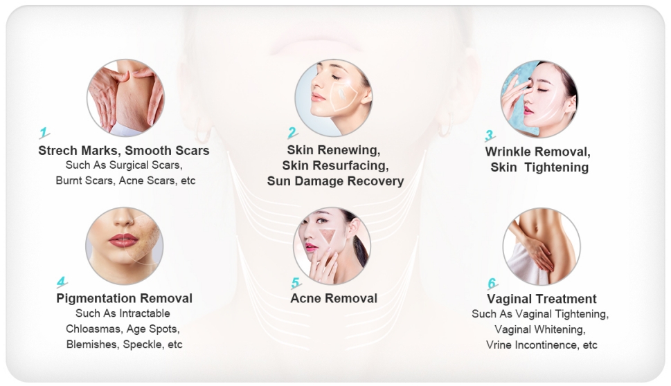 Understanding the Role of Medical Fractional CO2 Laser Machines in Skin Whitening